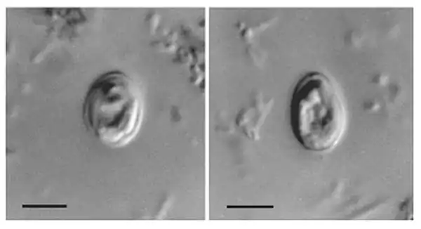 Nomarski interference contrast photomicrographs of Cryptosporidium muris from the feces of an HIV-positive human