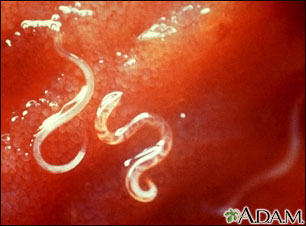 Hookworm - Ancylostoma caninum Hookworm - Ancylostoma caninum