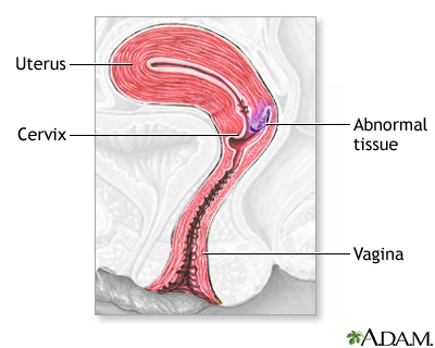 Indications Indications