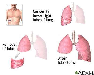 Procedure Procedure
