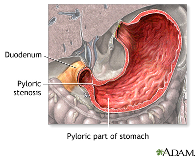 Indications Indications