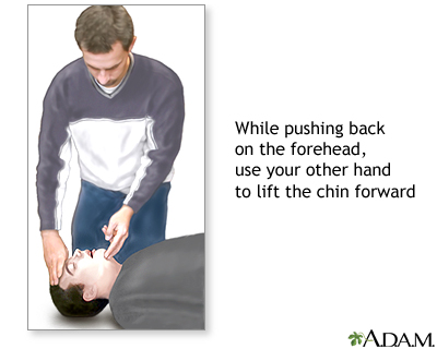 CPR - adult - series CPR - adult - series