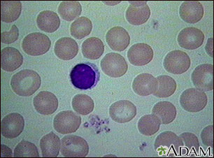 Red blood cells - normal Red blood cells - normal