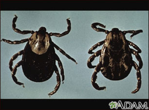 Ticks Ticks