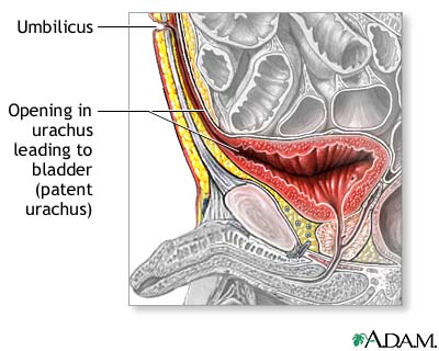 Indications Indications