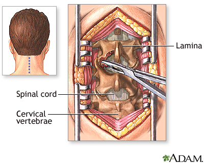 Procedure Procedure