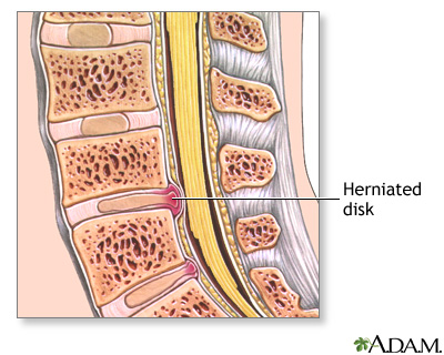 Indications Indications