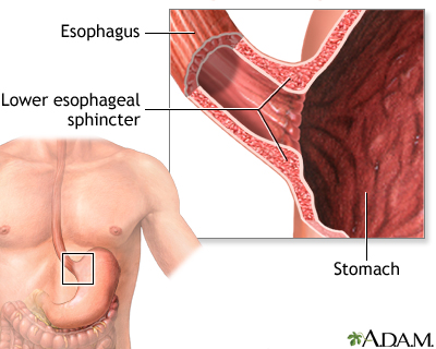 Achalasia - series Achalasia - series