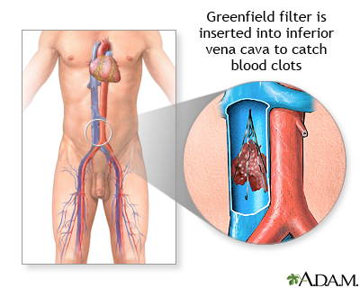 Procedure, part 2 Procedure, part 2