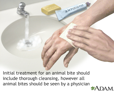 Animal bites Animal bites