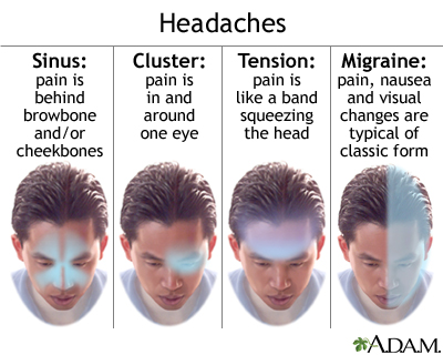 Headache Headache