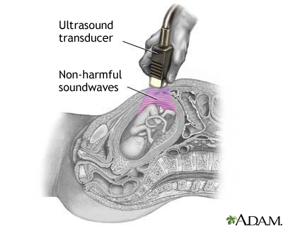Ultrasound Ultrasound