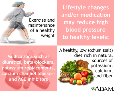 Lifestyle changes Lifestyle changes
