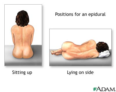 Procedure, part 2 Procedure, part 2