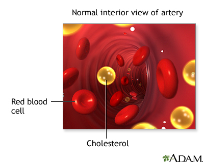 Cholesterol Cholesterol