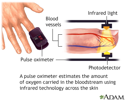 Pulse oximeter Pulse oximeter