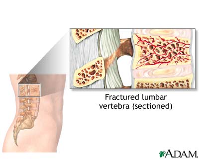 Indication Indication