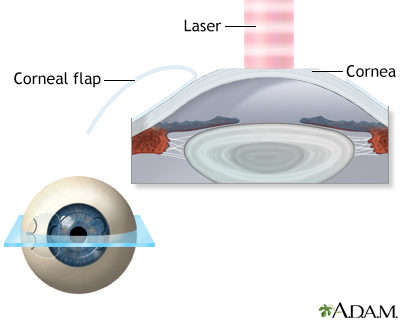 Procedure, part 3 Procedure, part 3