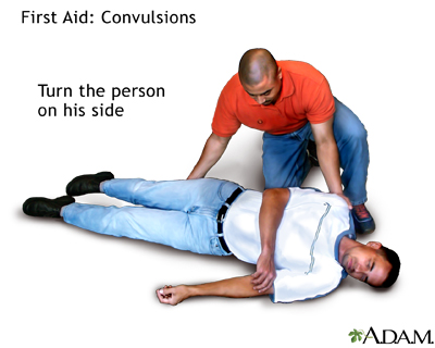 First aid convulsions, part 2 First aid convulsions, part 2