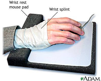 Wrist splint Wrist splint