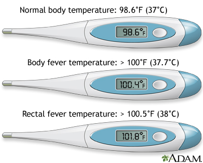 Thermometer temperature Thermometer temperature