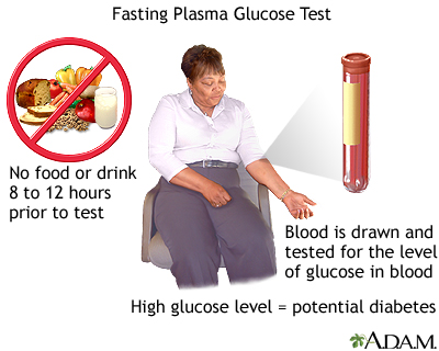Fasting plasma glucose test Fasting plasma glucose test