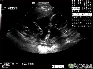 Ultrasound, normal fetus - arm and legs Ultrasound, normal fetus - arm and legs