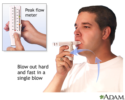 How to measure peak flow How to measure peak flow