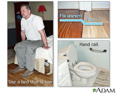 Preventing falls Preventing falls
