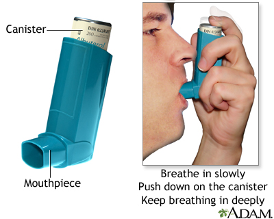 Inhaler medication administration Inhaler medication administration