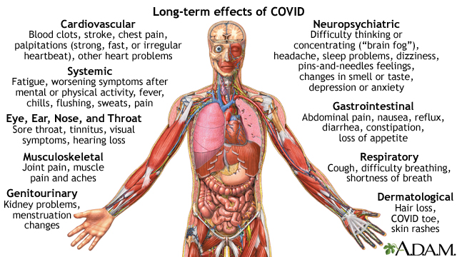 Long-term effects of COVID Long-term effects of COVID