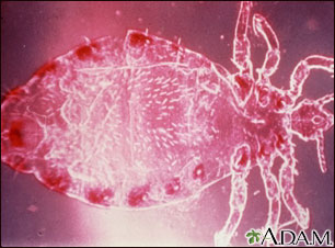 Head louse, male Head louse, male