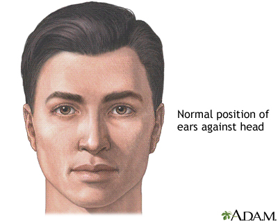 Ear surgery - series Ear surgery - series