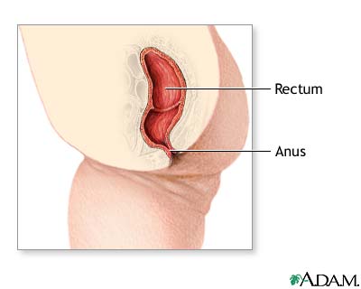 Imperforate anus repair - series Imperforate anus repair - series