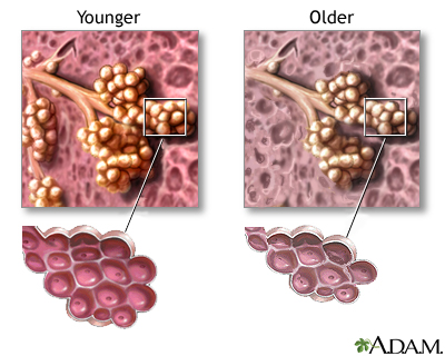 Changes in lung tissue with age Changes in lung tissue with age