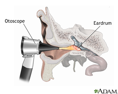 Otoscope examination Otoscope examination