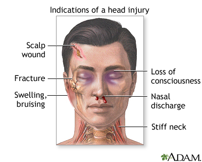 Indications of head injury Indications of head injury