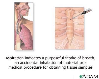 Aspiration Aspiration