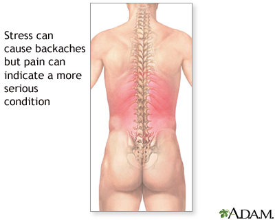 Backaches Backaches