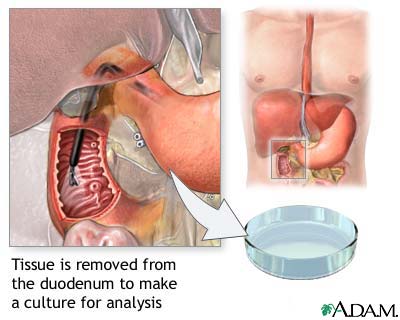 Duodenal tissue culture Duodenal tissue culture