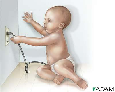 Electrical injury Electrical injury