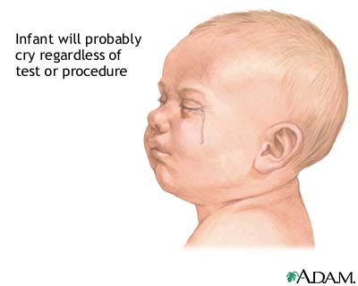 Infant test/procedure preparation