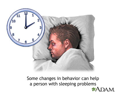 Insomnia concerns Insomnia concerns
