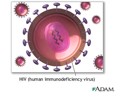 Asymptomatic HIV infection Asymptomatic HIV infection