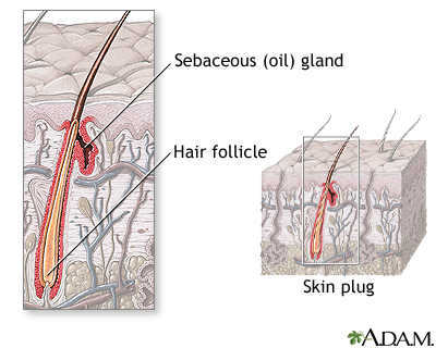 Hair follicle anatomy Hair follicle anatomy