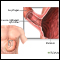 Achalasia - series