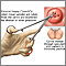 Cervical biopsy
