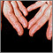 Amyloidosis of the fingers
