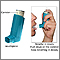 Inhaler medication administration