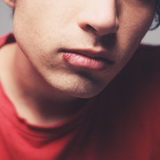 Cold Sore